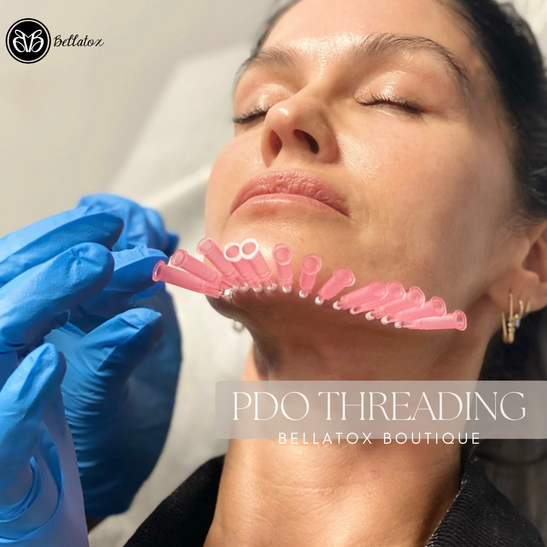 PDO Threading is a cosmetic facial rejuvenation procedure using FDA Approved PDO Threads to lift, tighten, firm and smooth your skin. PDO Threads perform lifting and volumizing by generating new collagen and enabling your skin care professional to lift and mold sagging skin into a more youthful position. The results are instant, will improve with time, can last for years, leave no scars, and best of all they are a true "injectable" alternative, or adjunct to surgical procedures as well as other skin rejuvenation treatments.
