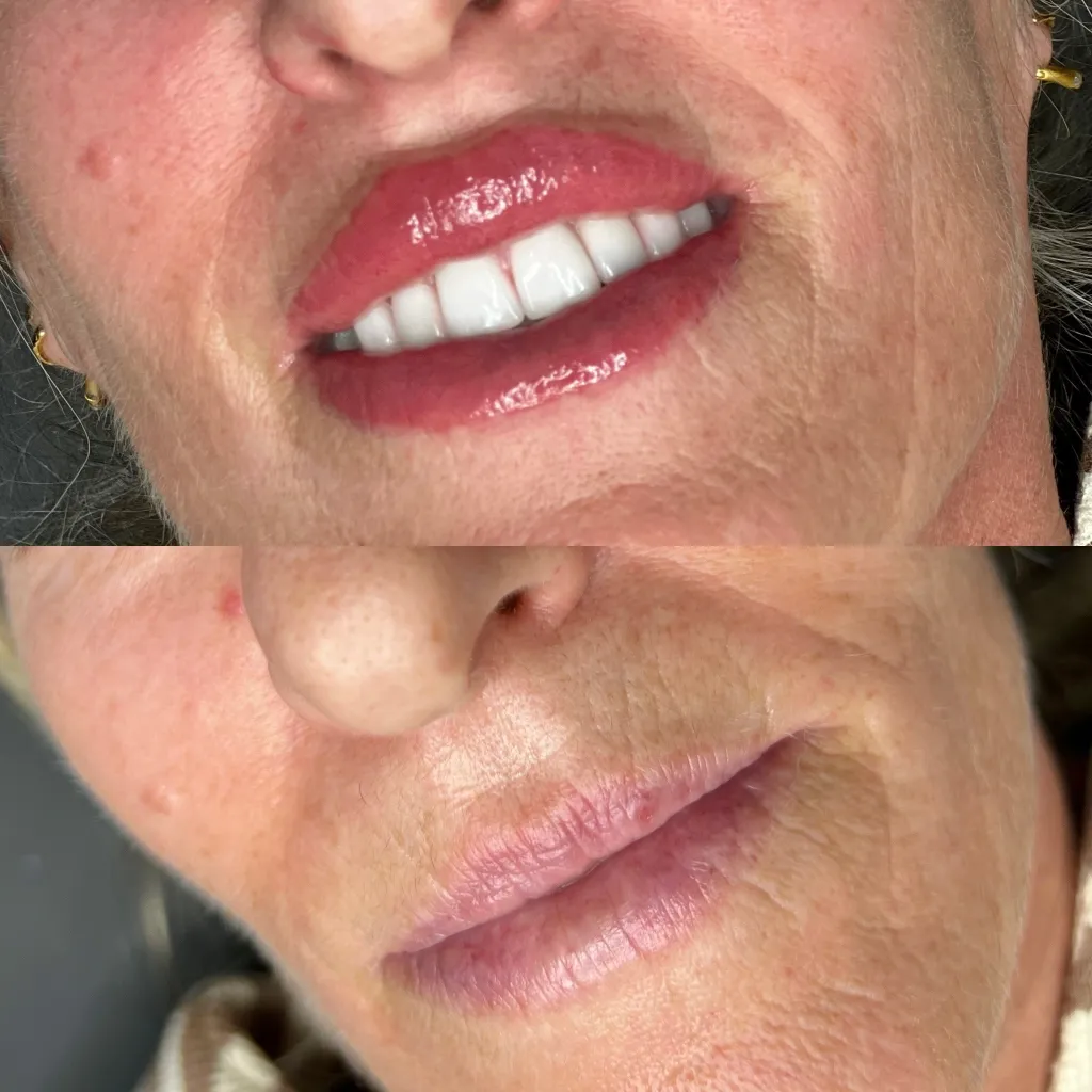 Bellatox Boutique - Lip Blushing Before and After